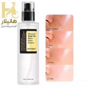 حلزون کوزارکس2