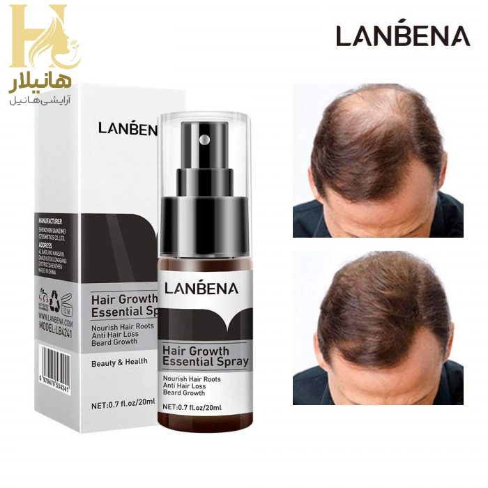 تقویت و رشد مو لانبنا